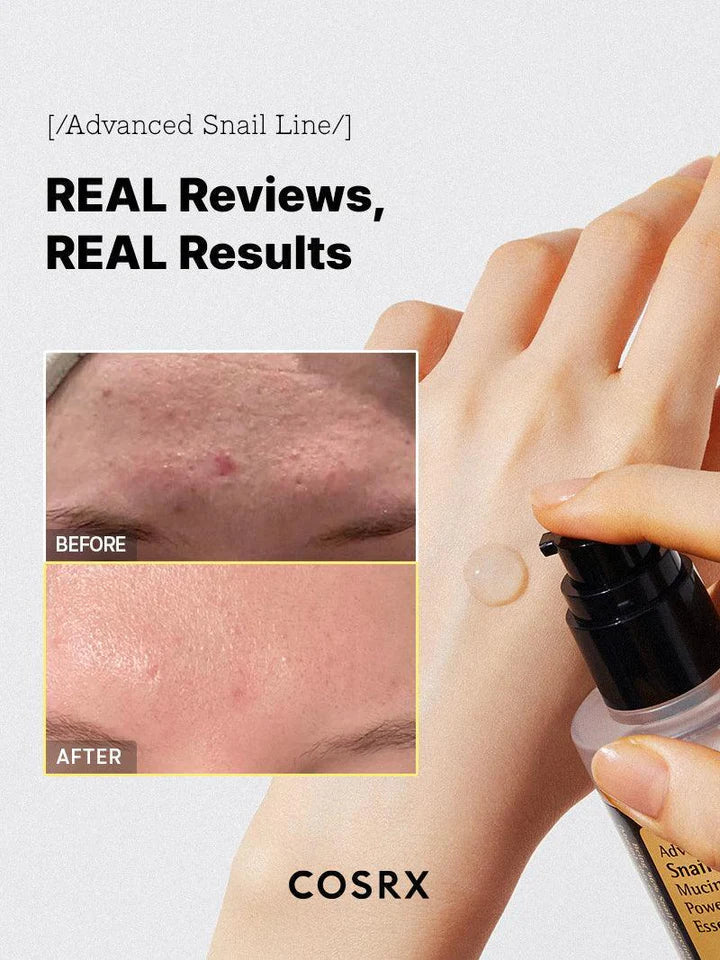 COSRX Advanced Snail Mucin Power Essence 100ml Essence Visage 96% Mucine Hydratation Réparation Régénération Anti-Âge