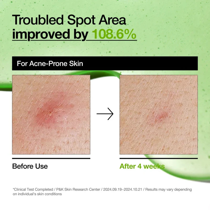 ANUA Azelaic Acid 10% Serum Hyaluronique 30ml Anti-Imperfections Éclat Taches Pigmentaires